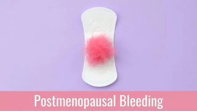 Postmenopausal Bleeding Treatment